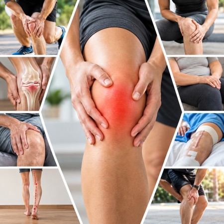 Häufige Ursachen von Kniebeschwerden wie Meniskusschäden, Kreuzbandverletzungen, Arthrose und Überlastungen in der Physiotherapie Babelsberg