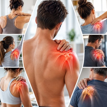 Häufige Ursachen von Schulterbeschwerden wie Frozen Shoulder, Impingement-Syndrom und Rotatorenmanschettenverletzungen in der Physiotherapie Babelsberg